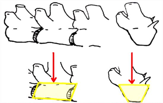 Hemivertebrae Are Congenitally Deformed Vertebra In Dogs And Cats Veterinary Partner Vin