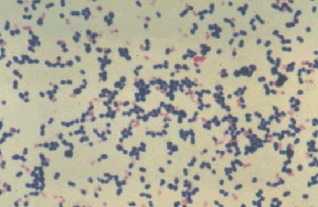Microscopic image of Gram positive cocci showing as purple dots