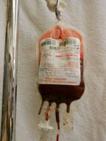 Photo of hanging bag containing blood for transfusion
