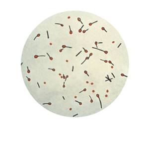 Microscopic image of cultured tetani spores 