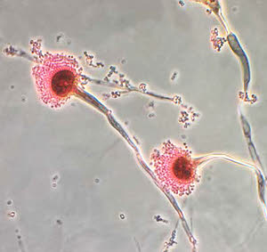 Microscopic image of pink Aspergillus spores