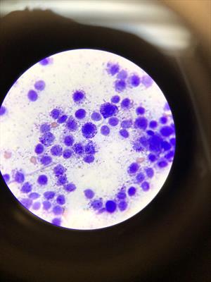 Fine Needle Aspirate From Dog's Scrotal Tumor Showing Mast Cells - Microphotograph