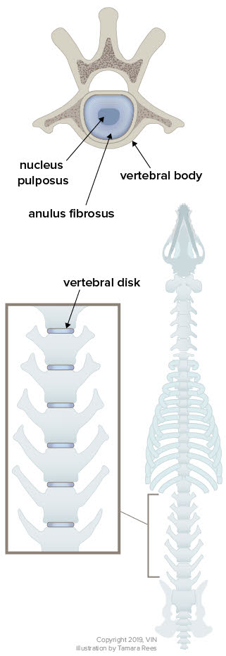 Vertebral Compression Fractures - Injuries; Poisoning - Merck Manuals  Professional Edition
