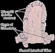 Image of parvo intestinal villus 