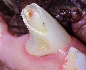 A fractured lower canine tooth with pulp exposure.