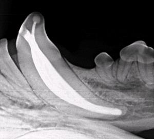 X-ray of a tooth showing the root 
