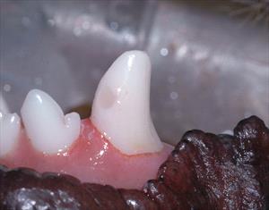 Tooth after bonding and shaping.
