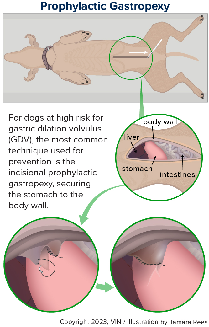 Diagram illustrating how prophylactic gastropexy works- and the outside of the stomach is tacked to the body wall.