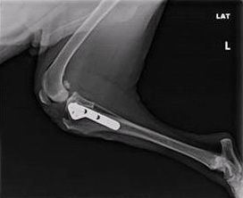 lateral (side) radiograph of knee post-surgery showing plate of tibia