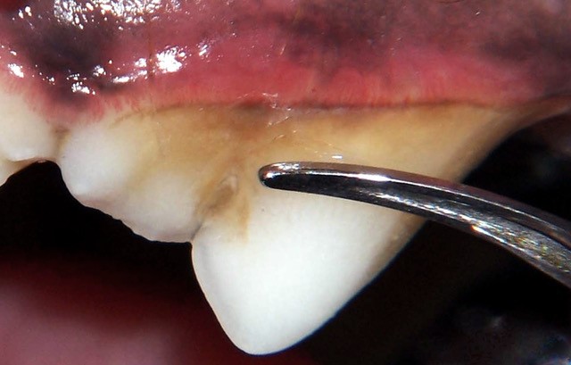 Image of a tooth with fairly heavy tarter