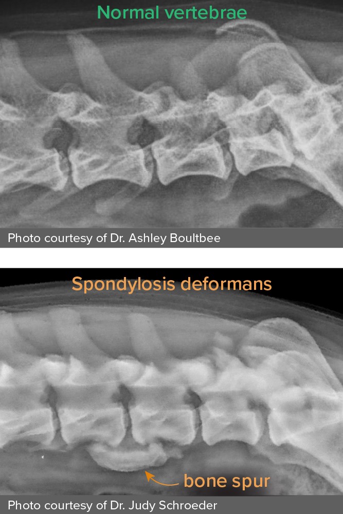 X-ray images of normal vertebrae and diseased vertebrae 